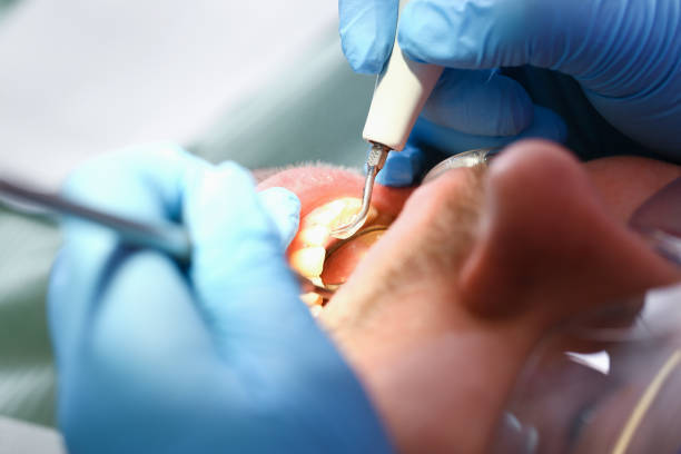 Best Emergency Care for Gum Disease in Seatac, WA