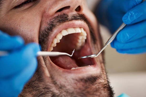 Best Emergency Treatment for Oral Infections in Seatac, WA