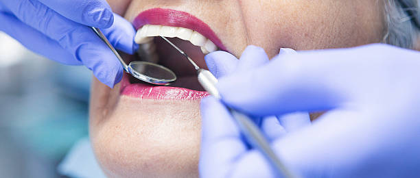 Best Emergency Denture Repair in Seatac, WA